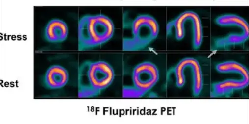 F-18 Flurpiridaz FLYRCARDO™
